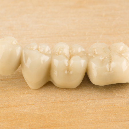 Dental crowns in Brisbane