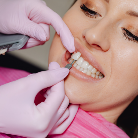 Veneers Brisbane