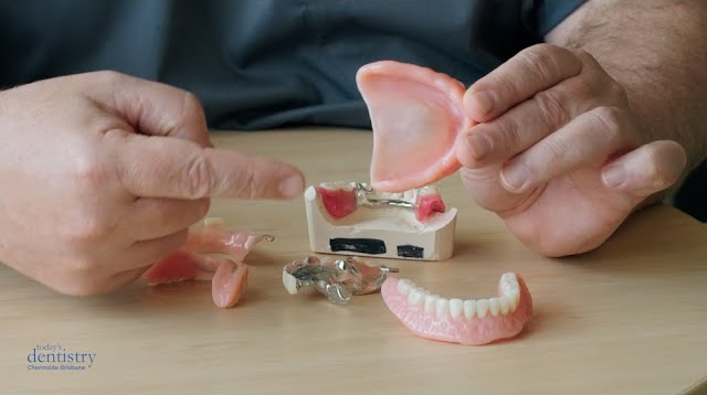 dentures video thumbnail