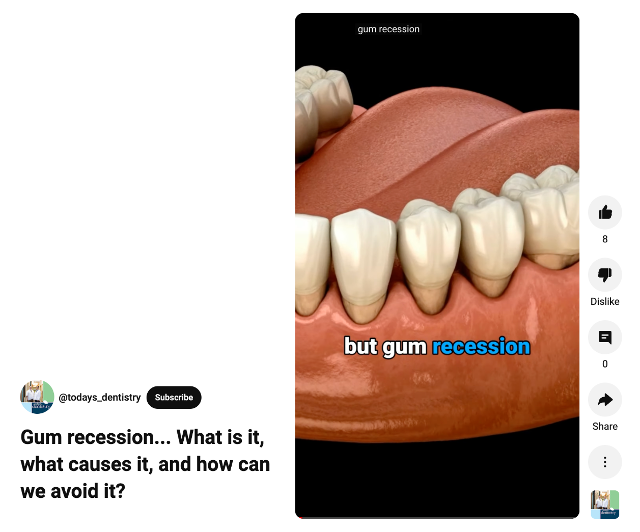 Gum Receding