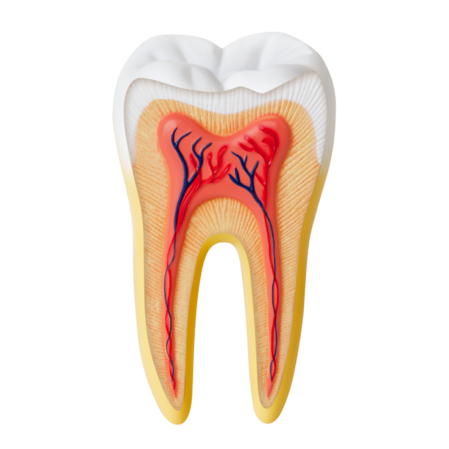 Root canal treatment Brisbane
