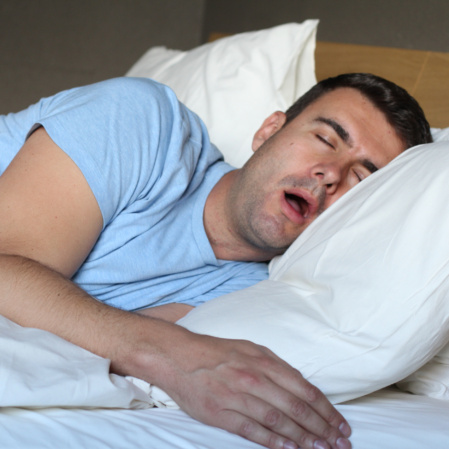 Sleep apnea mouth guard in Brisbane