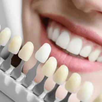 white straight teeth image
